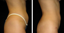 Before & After Photos